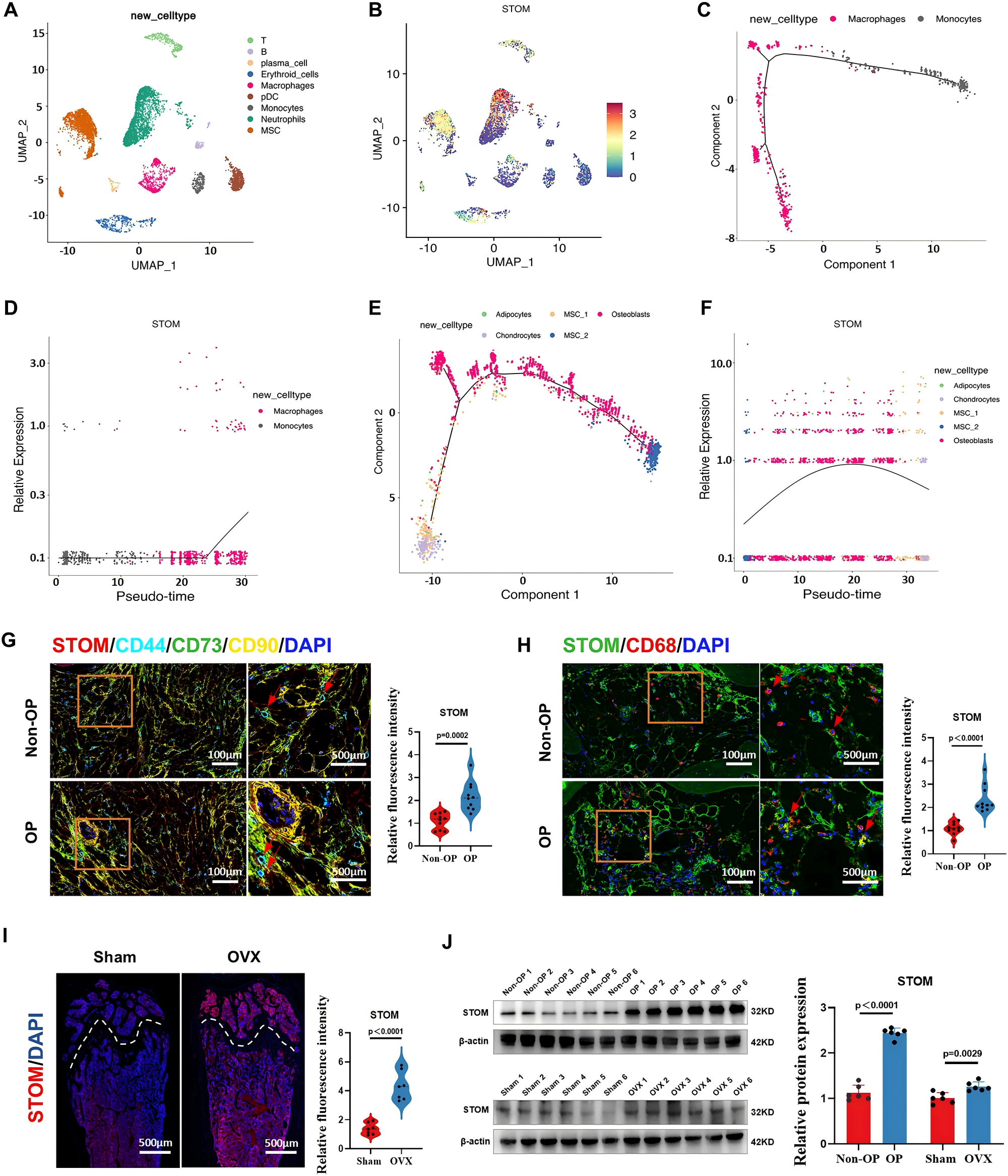 STOM expression in OP patients and OVX mouse models