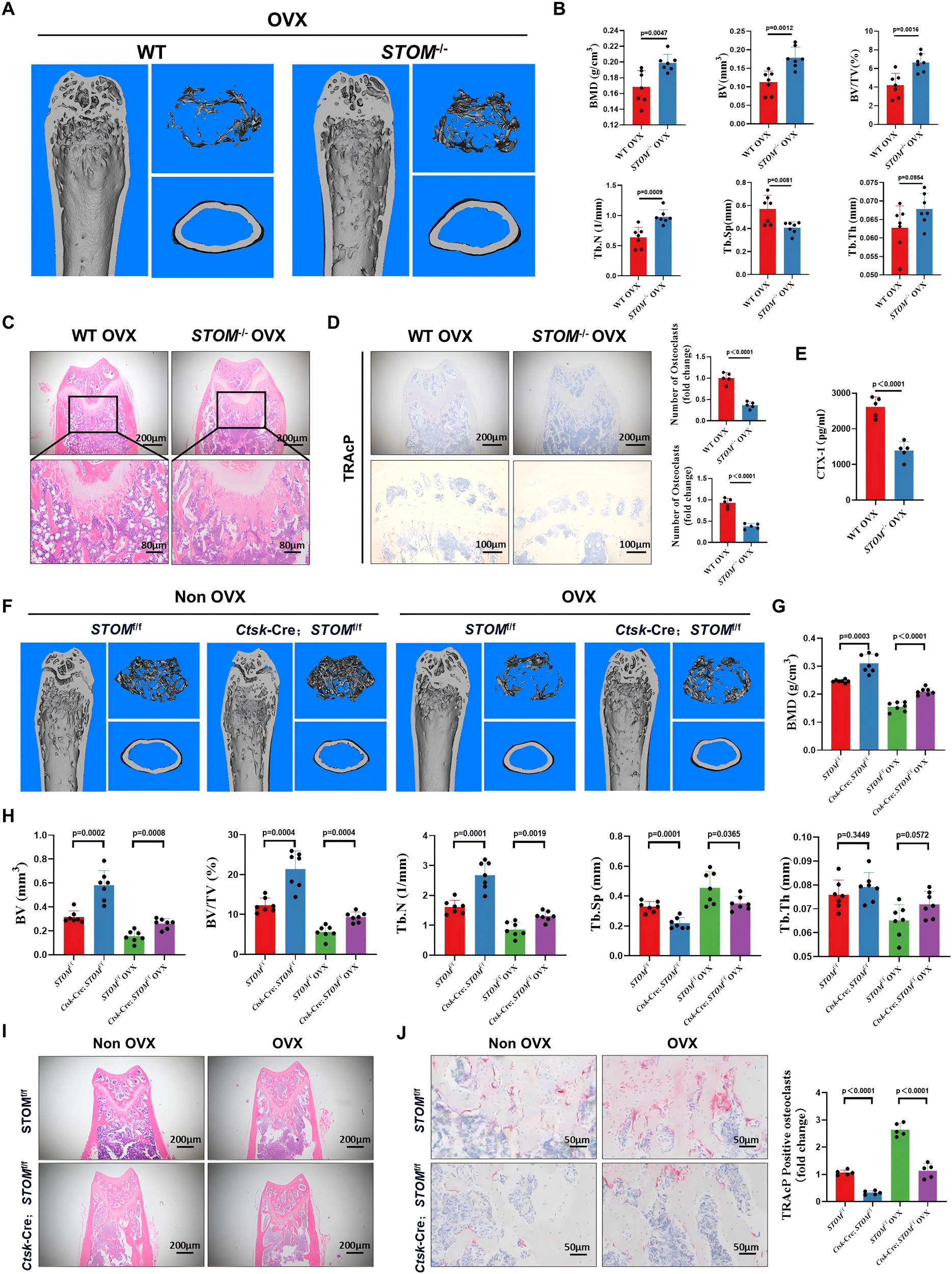 Phenotypic outcomes of systemic and osteoclast-specific STOM knockout