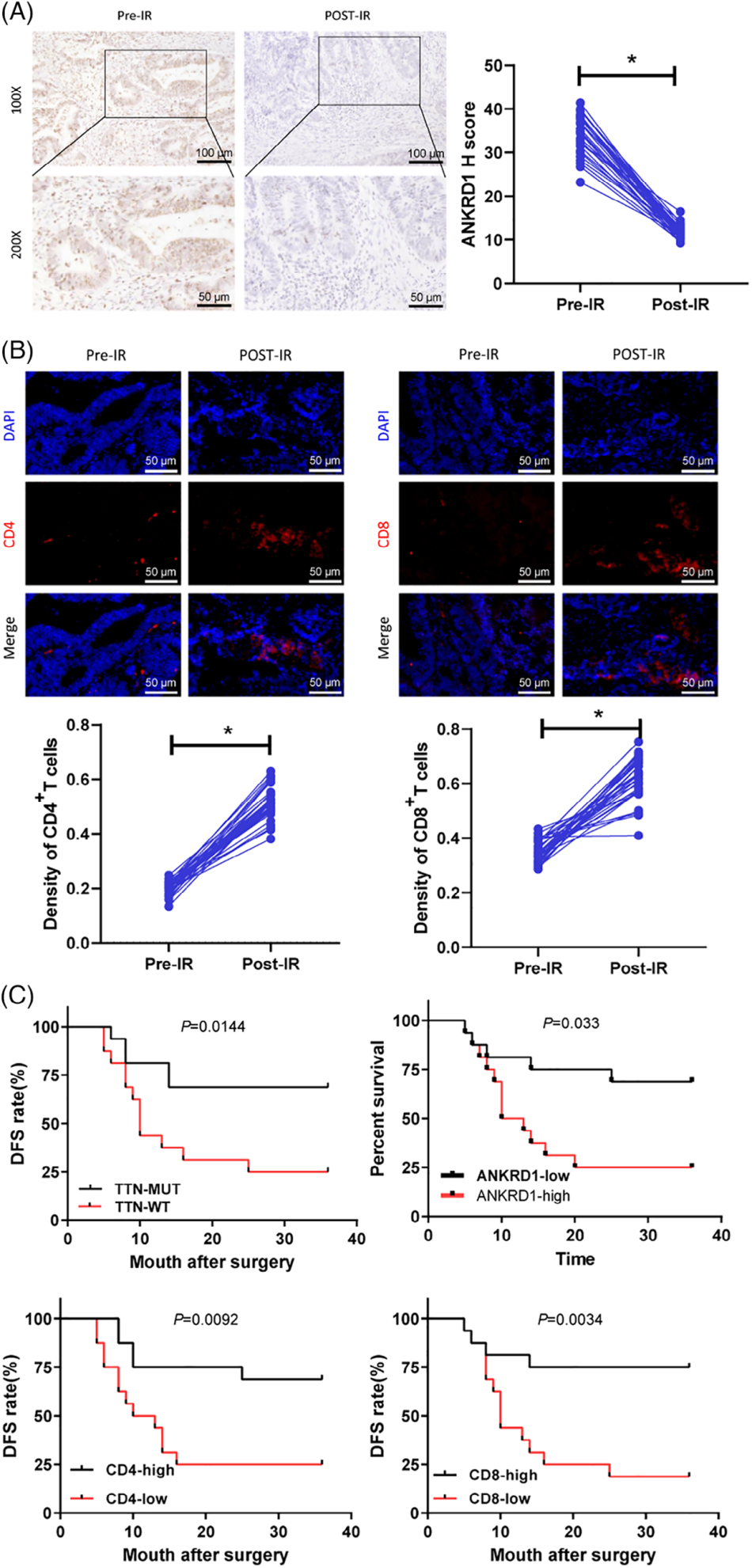 TTN mutation-driven immunogenic activation and its correlation with radiotherapy outcomes in READ patients.
