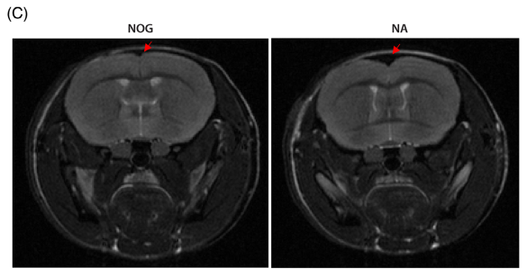 MRI scans