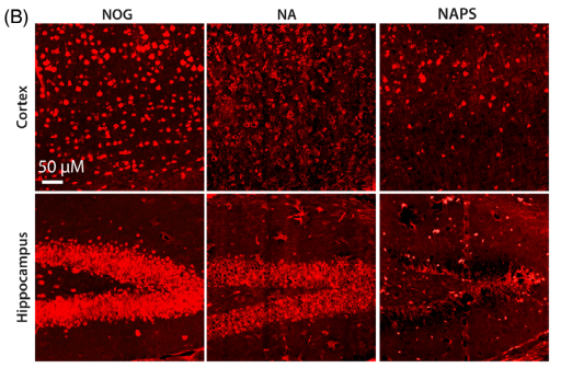 Neuronal loss and brain atrophy (NeuN/MAP2 staining)